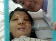 福建首例换脸手术成功 少女十年来第一次对镜微笑